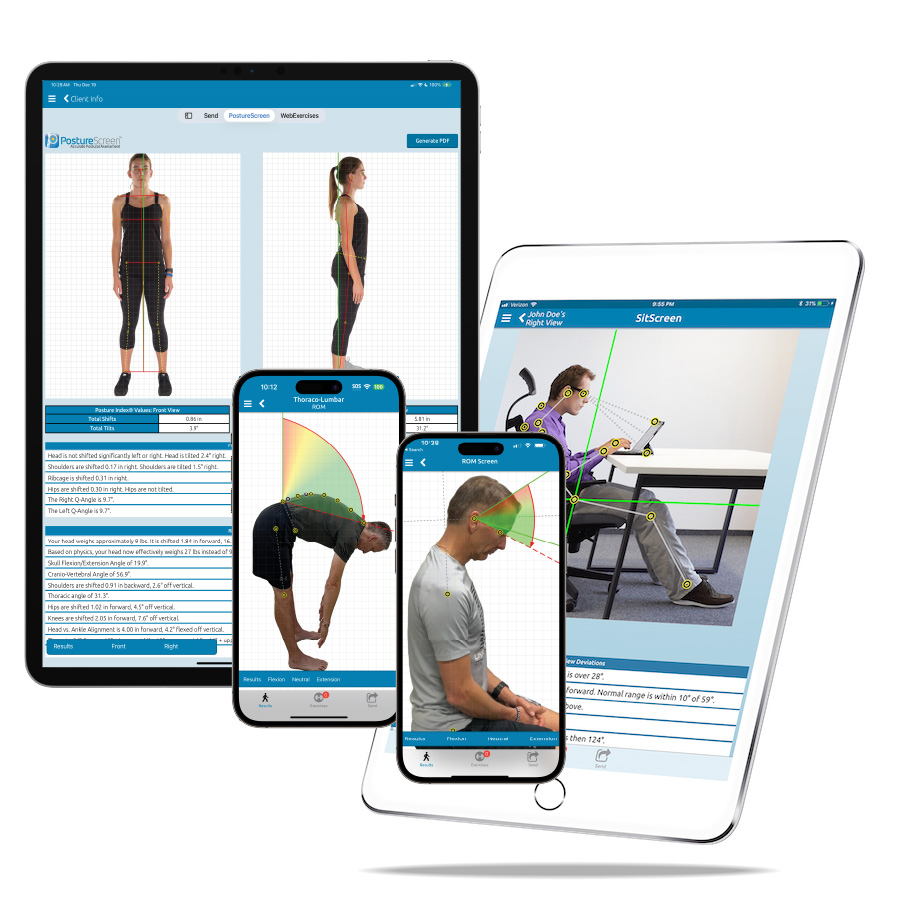 Posture Analysis and Rehab